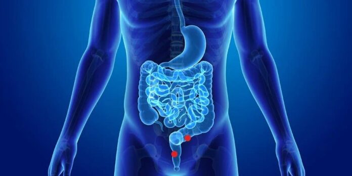 El tumor de colon está ligado a la vejez, según oncólogo