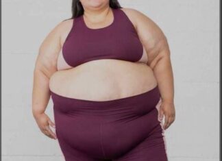 Mujeres con gigantomastia celebran acceso a cirugías cubiertas por seguro